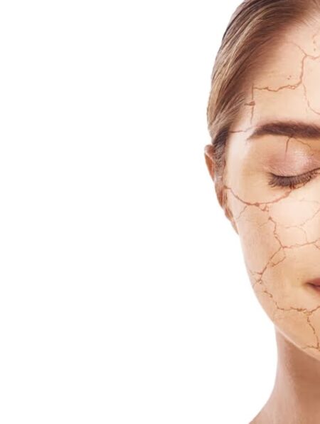 winter skincare tips for dry skin at home