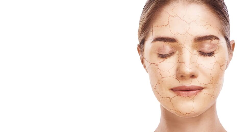 winter skincare tips for dry skin at home